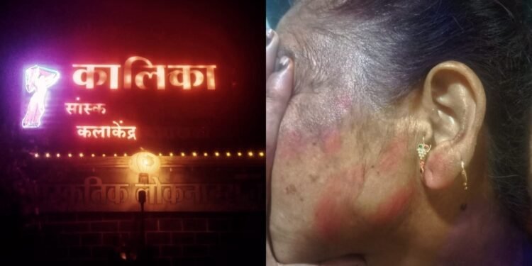 चोराखळी : डोळ्यात चटणी फेकून आणि पिस्तूल-सुऱ्याचा धाक दाखवून कालिका कलाकेंद्र चालकाच्या घरात सशस्त्र दरोडा