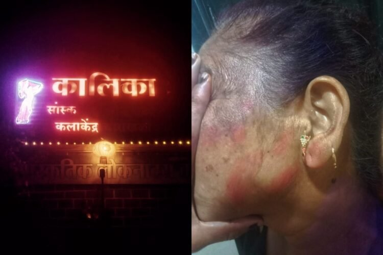 चोराखळी : डोळ्यात चटणी फेकून आणि पिस्तूल-सुऱ्याचा धाक दाखवून कालिका कलाकेंद्र चालकाच्या घरात सशस्त्र दरोडा