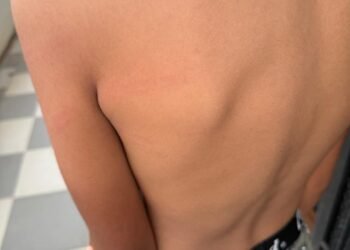 शाळेची वही आणली नाही म्हणून १३ वर्षीय विद्यार्थ्याला लाकडी काठीने बेदम मारहाण