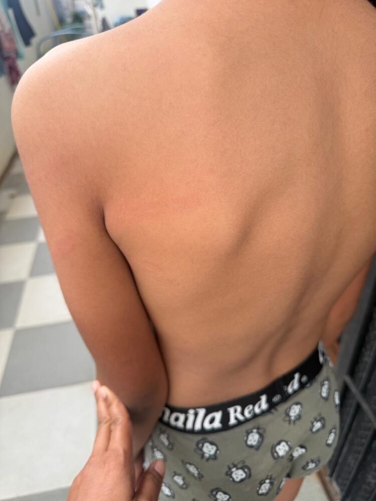 शाळेची वही आणली नाही म्हणून १३ वर्षीय विद्यार्थ्याला लाकडी काठीने बेदम मारहाण